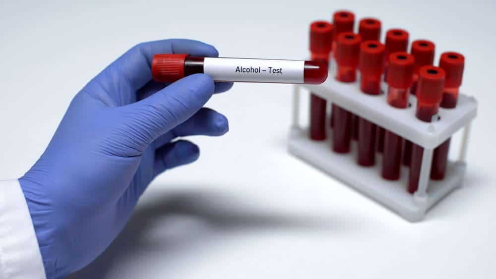 Image is of a lab technician holding an alcohol test sample, concept of CDL DUI lawyer reviewing BAC test evidence.