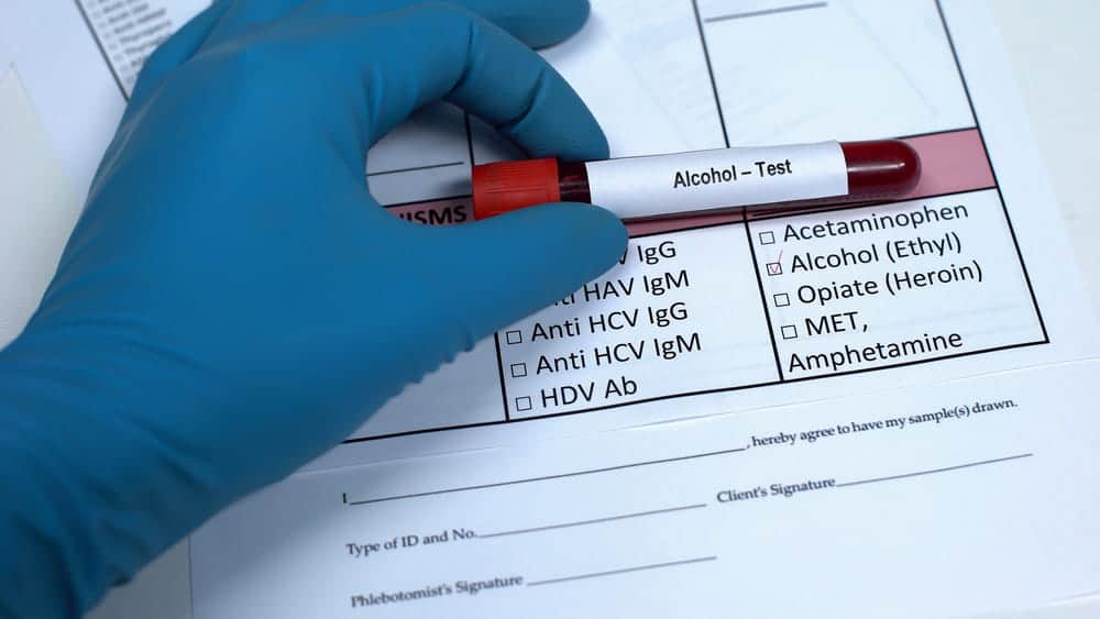 Image is of an alcohol test sample on a testing form, representing evidence that may affect CDL holders in Tennessee during DUI investigations.